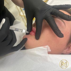 Foundation Dermal Fillers <span class="d-block fw-normal">Training Course</span>