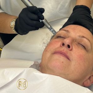 Microneedling <span class="d-block fw-normal">Training Course</span>